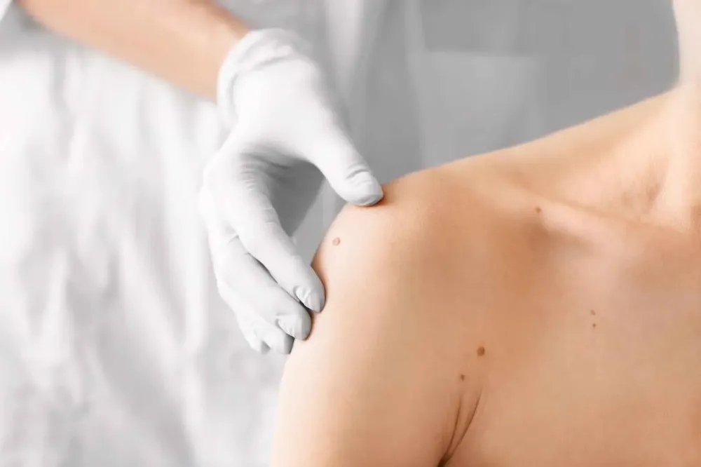 dermatologue